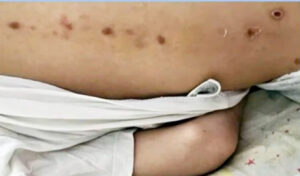 Patras: Key testimonies and new images of 10-year-old’s injuries