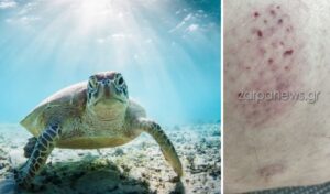 Sea turtle bites swimmer in Chania – What to do if you encounter one