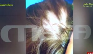 Shocking case in Aulona: Parents of a 2-year-old child reported that their toddler was abused by the daycare director