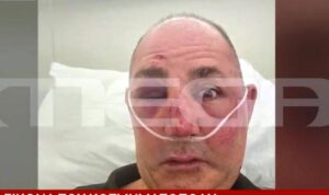 Rhodes jewelry store owner brutally beaten in €900,000 robbery