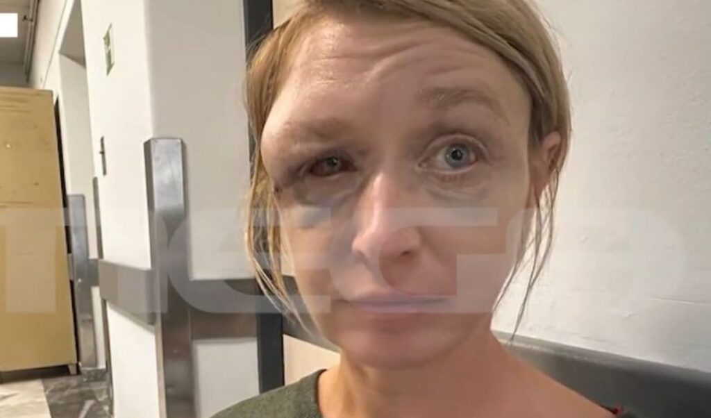 Brutal beating in Koropi: “My partner didn’t hit me, I don’t remember how I got hurt” – 40-year-old woman’s first words