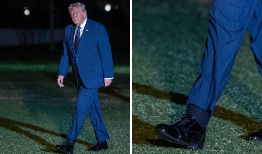 Trump health concerns: swollen ankle and neck rash spark debate