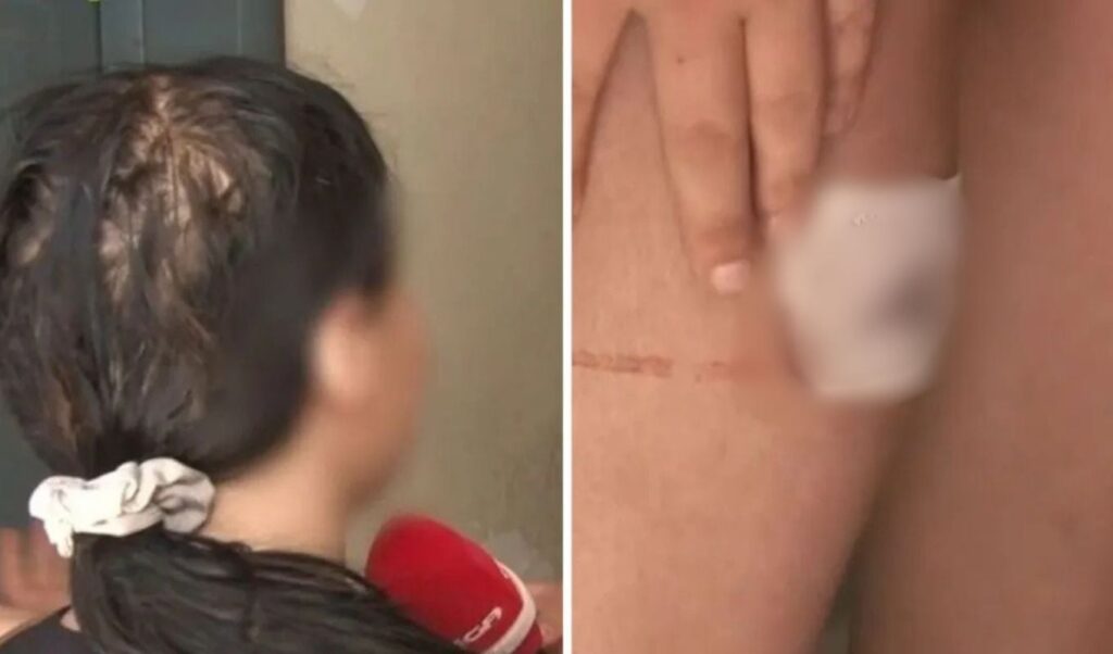 Kallithea stabbing: Teen victim speaks out about obsessive ex-boyfriend