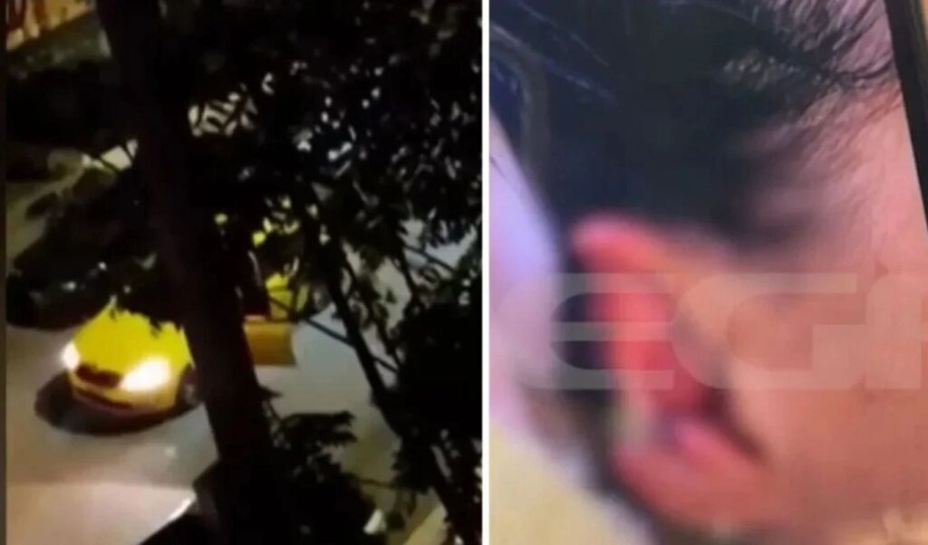 “Thank God I survived”: Taxi driver speaks out after passenger bit off part of her ear